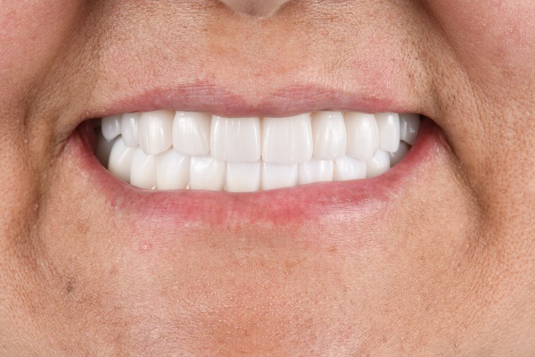 Teeth Whitening Treatment from Your Dentist
