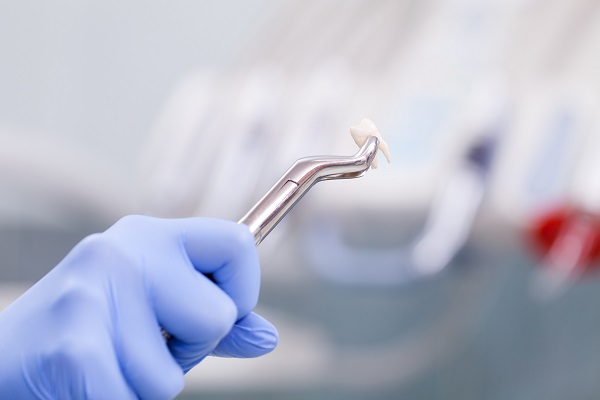 When to Have Wisdom Tooth Removal