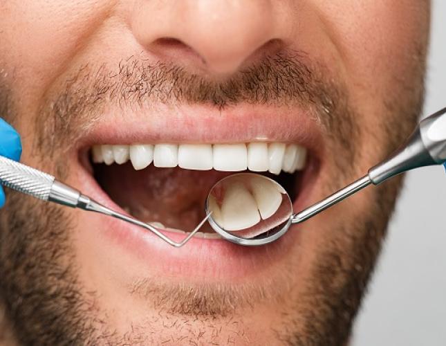 What You Should Know About Gum Disease